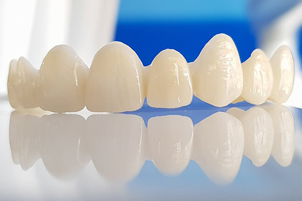 Zirconium Smile Design